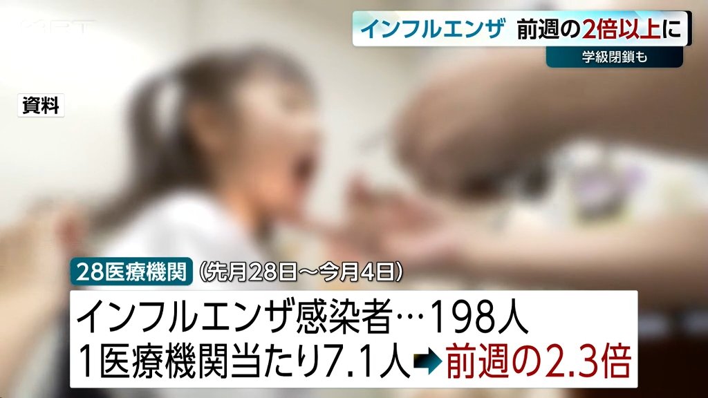 学級閉鎖の学校も　宮崎県内のインフルエンザ感染者が急増　前週比約2.3倍　例年の約29倍に
