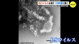 コロナと似た症状　2歳までにかかるという「RSウイルス」が流行　小児科医に聞くと…|TBS NEWS DIG