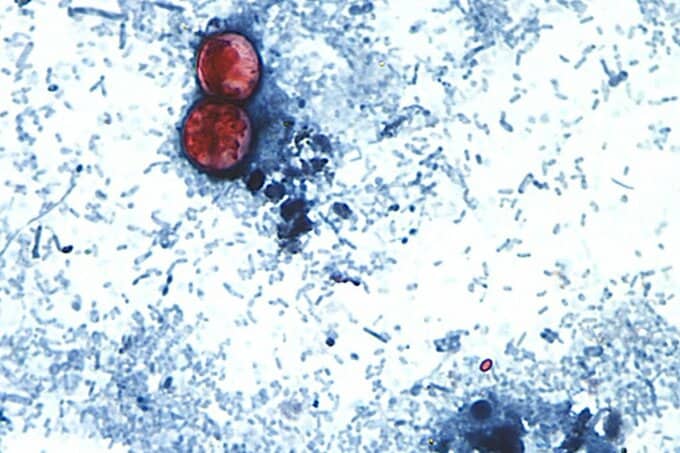 激しい下痢を引き起こす寄生虫感染、米中西部やニューヨークで拡大