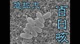 「百日咳」患者が急増 那覇市保健所管内で過去最多 乳児では死亡するケースも 保健所が感染拡大防止呼びかけ|TBS NEWS DIG