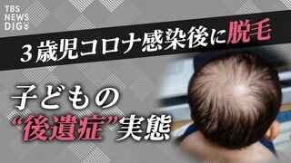 「風邪と同じは“暴論”」子どもにもコロナ後遺症「ぼく、どうなっちゃったの？」| TBS CROSS DIG with Bloomberg