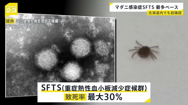 “マダニ感染症”過去最多ペース　今年に入って8月3日までに患者数124人 「SFTS＝重症熱性血小板減少症候群」|TBS NEWS DIG