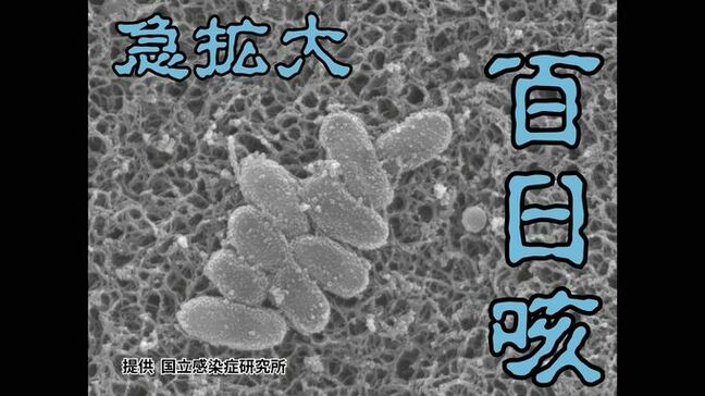 【感染拡大】乳児は死亡するケースもある「百日咳」　沖縄で過去最多を大きく上回るペースの感染拡大　県が注意呼びかけ|TBS NEWS DIG