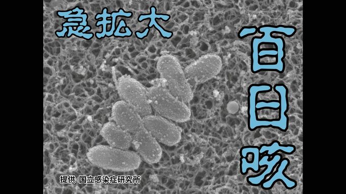 「百日咳」患者が急増　那覇市保健所管内で過去最多　乳児では死亡するケースも　保健所が感染拡大防止呼びかけ|TBS NEWS DIG