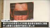「偽名を名乗らされた」13歳でハンセン病を発症した男性が受けた差別 パネル展を通じ訴えたいこと「誤った施策を通じて悲しい人生を歩んだ人がいることを知ってほしい」|TBS NEWS DIG