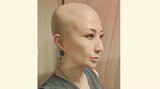 【がん闘病】　西丸優子さん　 "まつ毛の脱毛"　 「やはり抗がん剤には勝てないかー」　抗がん剤の前後で比較「ツケマデビューするしかない！」|TBS NEWS DIG