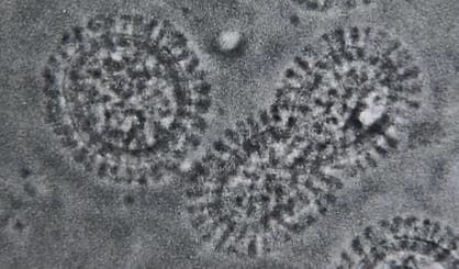 インフルエンザの流行期に　長野市で今シーズン初めての集団発生…学級閉鎖に　|　SBC NEWS | 長野のニュース | SBC信越放送