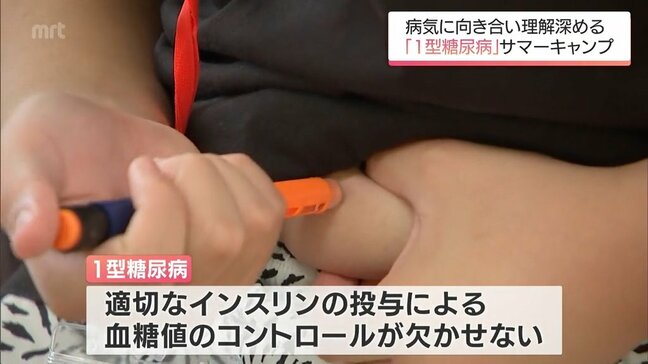 「1型糖尿病」の子どもたちが病気を理解し向き合っていくためのサマーキャンプ　都城市で始まる|TBS NEWS DIG