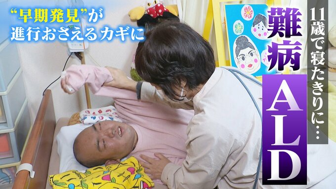 1万5000人に1人…遺伝性の難病ALD 早期発見で進行抑えられるが検査は自治体間で“差” 難病と闘う２つの家族　|　名古屋・愛知・岐阜・三重のニュース【CBC news】 | CBC web