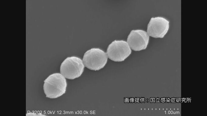 致死率3割～7割「劇症型溶連菌」 過去最多の去年上回るペースで増加　約2か月で378人　去年の4割超|TBS NEWS DIG