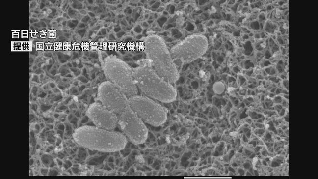 乳児は重症化のおそれもある「百日せき」過去最多ペースでの増加続く　患者の約7割が10代【長崎】|TBS NEWS DIG