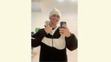 【白血病】ネイボールさん「糖尿病ではない」と確定の診断「僕の目標は『白血病以外の病気にならない!』」|TBS NEWS DIG