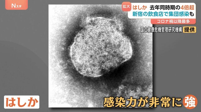 コロナ禍以降で最多…はしかが感染拡大 感染者が去年同時期の4倍超に 肺炎や中耳炎の恐れも【Nスタ】|TBS NEWS DIG