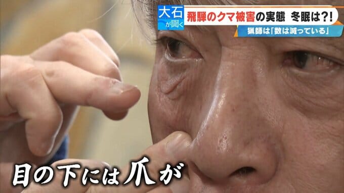 クマに恐われた男性｢これもうだめだと…｣ 過去最悪の被害の一方で猟友会は｢数が減ってきている｣ 駆除されたクマの“ある特徴”とは　|　名古屋・愛知・岐阜・三重のニュース【CBC news】 | CBC web