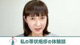 【 がん闘病 】古村比呂さん 帯状疱疹の体験を報告「こんなに薬が効かないのは、もしかしたら脳転移してるかもしれないと、不安もよぎってしまいまして」|TBS NEWS DIG