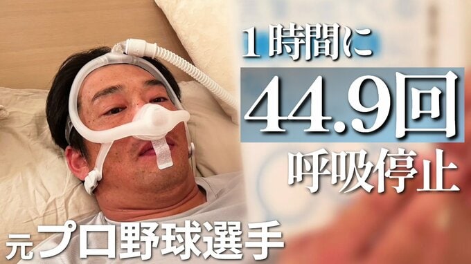 「1時間に44.9回、呼吸が止まっています」元プロ野球選手天谷宗一郎さん 「眠りを取り戻す」CPAP治療で変わった生活【全5回シリーズ4回目】 | RCC NEWS | 広島ニュース | RCC中国放送