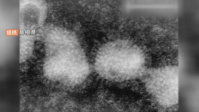 「熱の薬、咳の薬、鼻水の薬、喉の薬、全部不足」去年の倍以上の予約…早くも流行インフルの影響　|　BSSニュース | BSS山陰放送