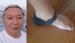 【 鈴木おさむ 】 「足底腱膜炎になりました。多分。めっちゃ痛いです」「日に日に痛みは増してる感じが」　現況明かす|TBS NEWS DIG