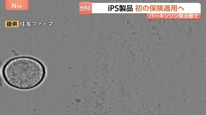 iPS細胞使った再生医療製品 公的医療保険の適用を了承　パーキンソン病治療“年内に1人目の移植を目指す”|TBS NEWS DIG