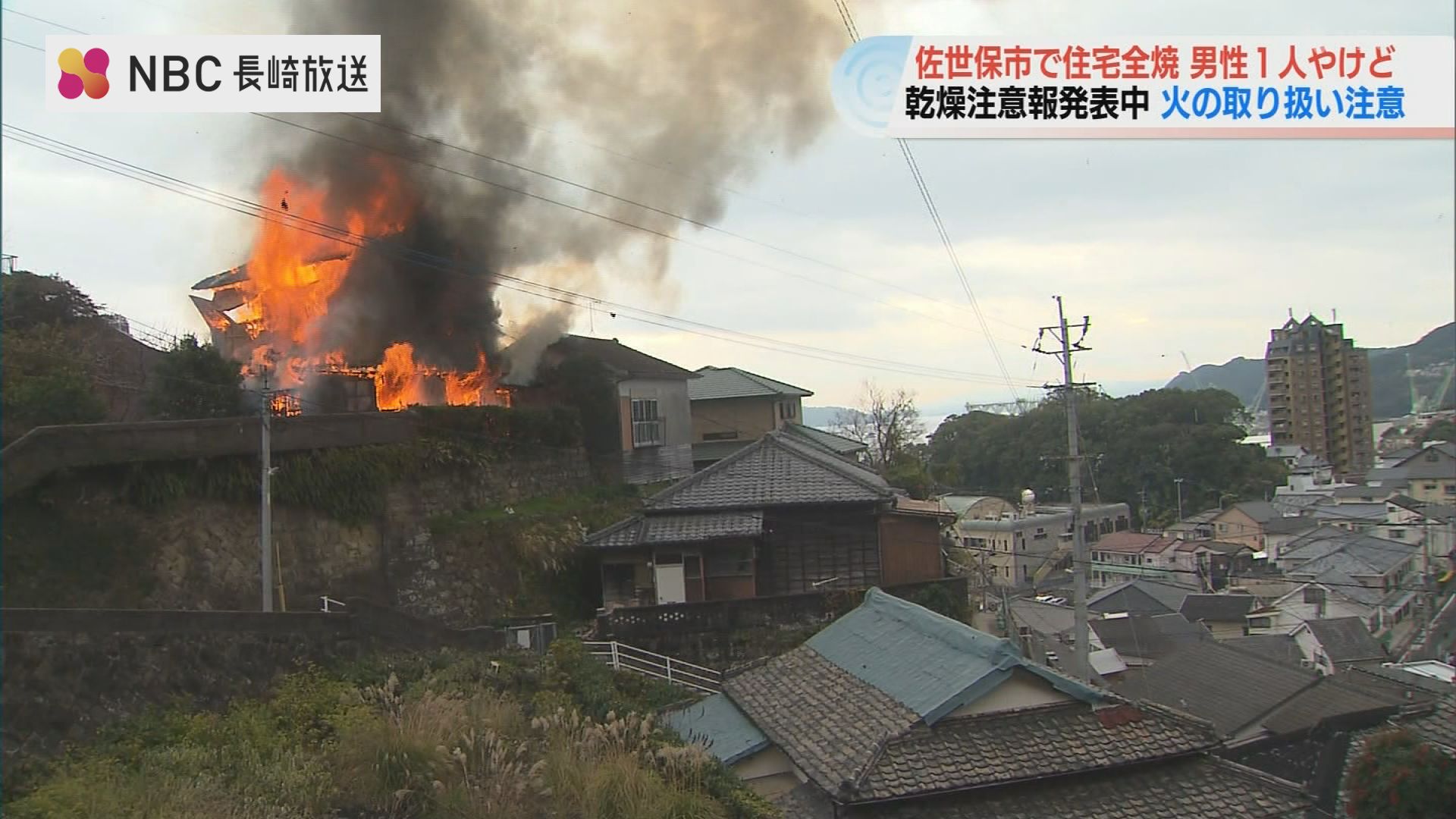 長崎県佐世保市で民家1棟を全焼 住人の男性（82）が顔などにやけど