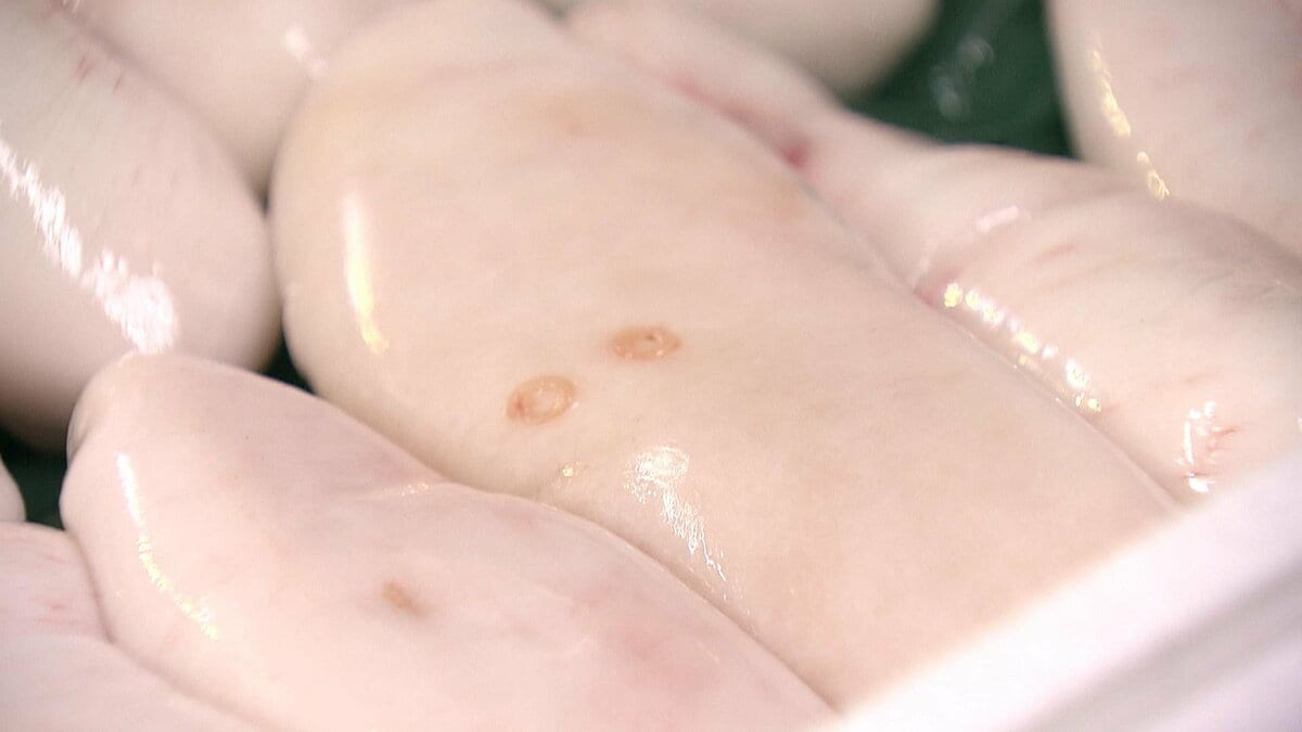 針かナイフで胃をチクチク」激痛襲う“アニサキス”食中毒はナゼ