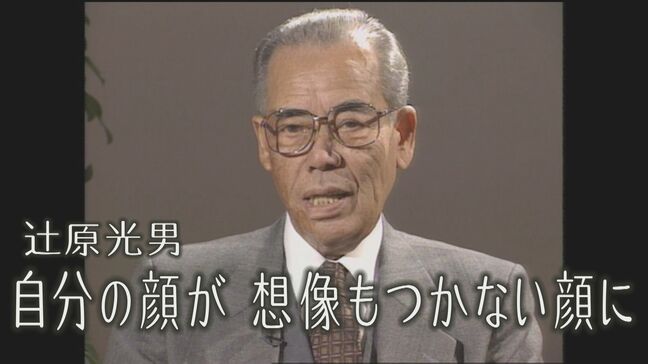 「自分の顔が 想像もつかない顔に」ヒバクシャの声#25辻原光男|TBS NEWS DIG