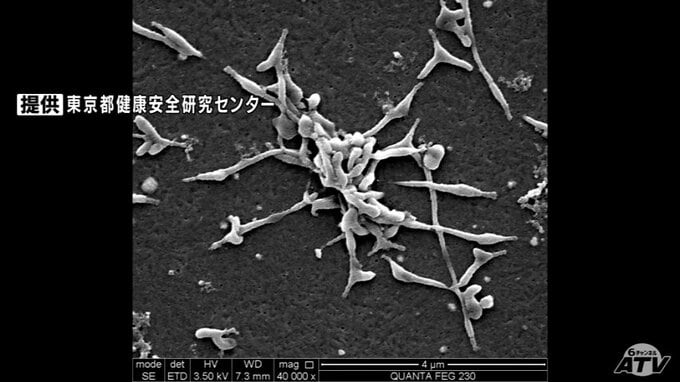 全国で流行中の「マイコプラズマ肺炎」青森県は2週連続で“全国ワースト”　1医療機関あたりの患者数が4人　|　青森のニュース│ATV NEWS│青森テレビ