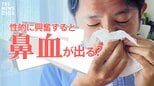 性的に興奮して「鼻血ブー」…これ、ホント? その“元祖”は1970年代のギャグ漫画にあった|TBS NEWS DIG