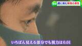 「見えないのに本を開いてしまっていた」壁に挑む “弱視のクライマー” ほぼ視界がない中クライミングに挑む理由とは【岡山】 |TBS NEWS DIG