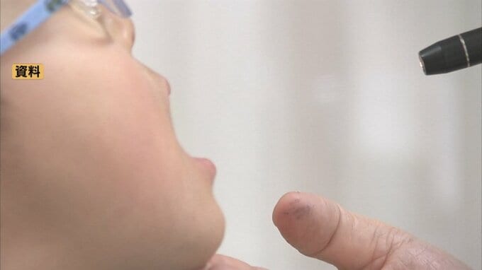 富山県内のインフル警報レベル下回る　2週連続減少もＢ型の感染が顕著　地域別には富山が31.06人と最多　　|　富山のニュース｜天気・防災｜チューリップテレビ