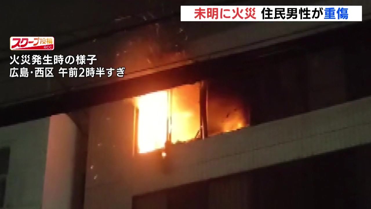 集合住宅で火事 住民1人がやけどを負う重傷 広島 | RCC NEWS | 広島