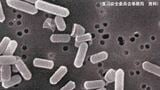 カレーなど加熱・煮込み料理で食中毒 原因のウエルシュ菌 知っておきたい基礎知識と対策 | 山梨のニュース | UTYテレビ山梨