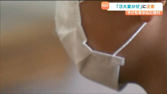 「3大夏かぜ」に注意 子どもを中心に夏に流行 医師に”対策”を聞いてみた 宮城 |TBS NEWS DIG