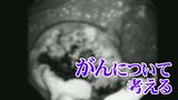 「がん検診」に異変 早期がんの発見が減り “すでに転移” 進行がんが増えている ワールドキャンサーデー2月4日に考える 富山 | 富山のニュース|天気・防災|チューリップテレビ