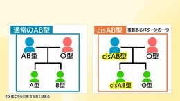 AB型とO型の両親からありえない血液型の子が? 全国に約1500人 四国に多い「cisAB型」とは|TBS NEWS DIG