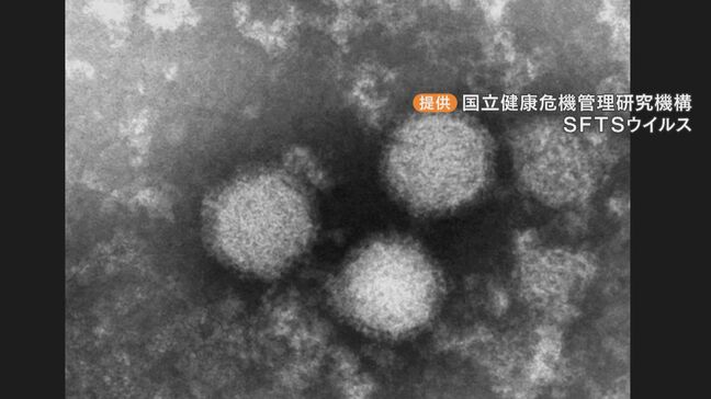 マダニ感染症「SFTS」広がる 愛知で2人死亡 草むらで除草作業した50代女性も 豊田市|TBS NEWS DIG