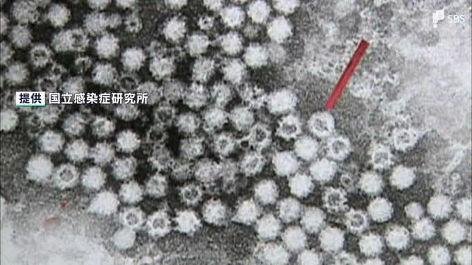 男女43人が「ノロウイルス」による食中毒 しゃぶしゃぶ・日本料理レストランで飲食 営業禁止に＝浜松市|TBS NEWS DIG