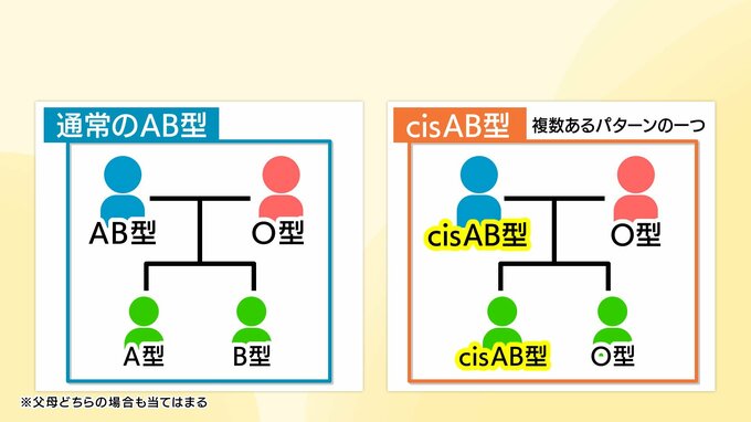 AB型とO型の両親からありえない血液型の子が？　全国に約1500人　四国に多い「cisAB型」とは|TBS NEWS DIG