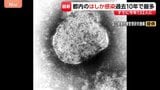 感染者の9割近くが“10～30代”　東京都内の「はしか」過去10年で最多に　感染力が非常に強く発熱・発疹や肺炎も|TBS NEWS DIG