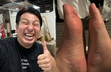 「久々痛風出ました!人生おわたっ!」 レインボー・ジャンボたかおさん SNSで報告|TBS NEWS DIG