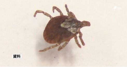 マダニにかまれたか？80代男性が重症熱性血小板減少症候群に感染　静岡県内では2023年3例目　|　静岡のニュース | SBSNEWS | 静岡放送