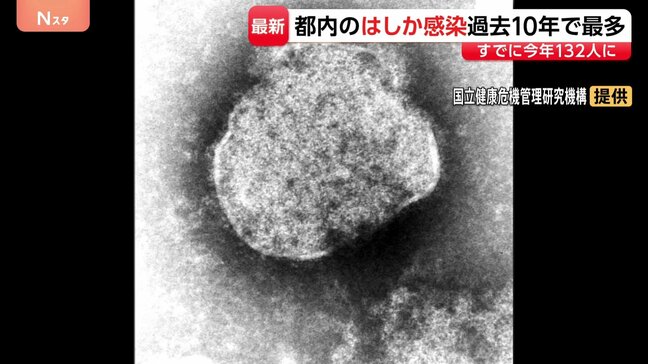 感染者の9割近くが“10~30代” 東京都内の「はしか」過去10年で最多に 感染力が非常に強く発熱・発疹や肺炎も|TBS NEWS DIG