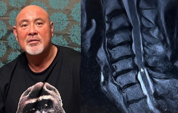 【 武藤敬司 】右手にしびれがあり頸椎のMRIを撮影「治療の注射、、怖いよ〜〜」|TBS NEWS DIG