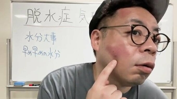 【 ダイアン・ユースケ 】　脱水症で「気づいたら倒れてた」　顔面負傷し「鼻血がポトポト」|TBS NEWS DIG