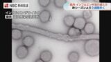 インフルエンザ流行期入り 昨季より3週間早く新学期前に感染対策呼びかけ【長崎】 | 長崎のニュース | 天気 | NBC長崎放送