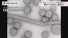 インフルエンザ流行期入り 昨季より3週間早く新学期前に感染対策呼びかけ【長崎】　|　長崎のニュース | 天気 | NBC長崎放送