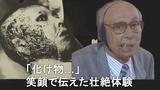 「キムタクに似てた」850mで被爆…ケロイド残る壮絶な人生 𠮷田勝二さん、今年の「長崎平和宣言」に登場へ|TBS NEWS DIG