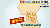 「うまくいけば仕事しながら治療できる」“世界初”食道がんのウイルス製剤「テロメライシン」販売開始 薬価約930万円も保険適用の対象に|TBS NEWS DIG