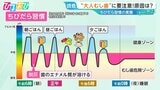 “大人虫歯”の原因『ちびだら習慣』って何?予防に効果的な「ガム」の噛み方を専門家が伝授【ひるおび】|TBS NEWS DIG