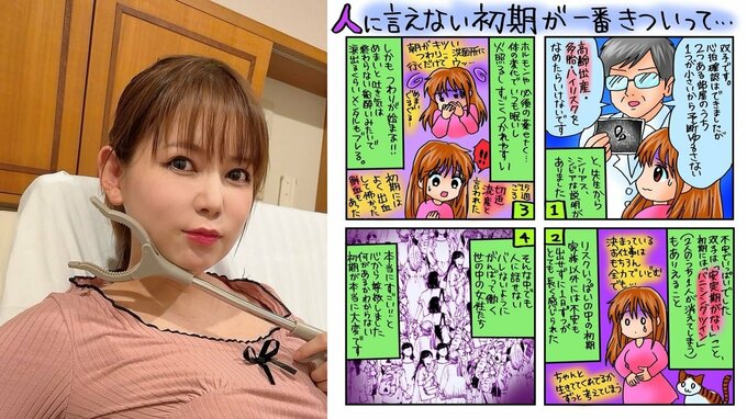 【 中川翔子 】双子出産目前　絵日記で「ふしぎ」「初期がきつい」　妊娠初期に働く女性達に尊敬とエール|TBS NEWS DIG